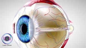 چگونه عفونت چشم را در 24 ساعت درمان کنیم