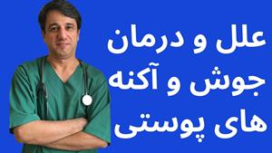 علل و درمان جوش و آکنه های پوستی