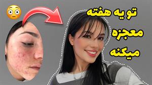 بدون هزینه پوستتو مثل پوست بچه کن