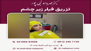 تزریق فیلر در زیر چشم