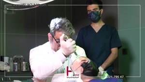 تجربه کاشت مو بدون درد با تکنیک‌های بی حسی در کلینیک هلیا