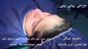 فیلم عمل بینی توسط جراح پلاستیک در ایران