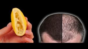رشد سریع مو با لیمو