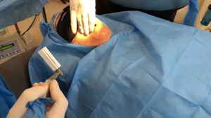 فیلم جراحی ایمپلنت دندان برای ترس از دندانپزشکی 