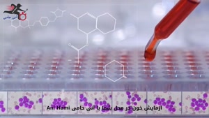 آزمایش خون در محل شما با آنی حامی Ani Hami