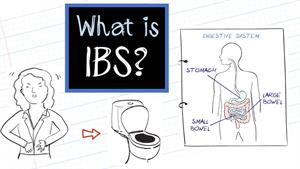 IBS چیست؟ (سندرم روده تحریک‌پذیر)