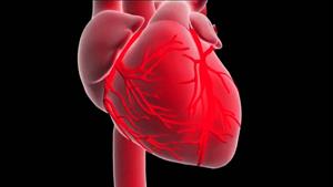 انفارکتوس میوکارد یا حمله قلبی چیست؟