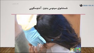 جراحی سینوزیت با دوبله فارسی