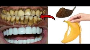 سفید کردن و جرم گیری دندان در 1 دقیقه