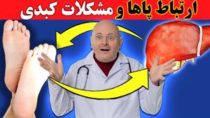 ۹ چیزی که پاهای شما درباره سلامت کبدتان به شما می گویند ! ( 