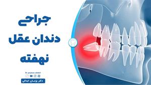 جراحی دندان عقل نهفته