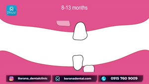 ترتیب رشد دندان‌های شیری