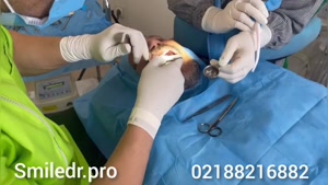 فیلم انجام جراحی ایمپلنت دندان با متخصص لثه 