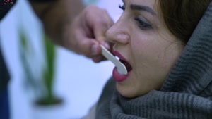 انجام لمینت دندان از نوع E-Max در دندانپزشکی بارانا