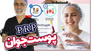 PRP-پی آر پی پیشرفته دکتر علیرضا بلندی | جوانسازی دائمی