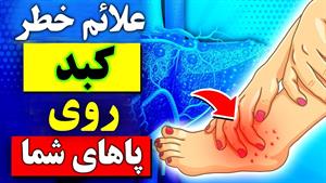 ۹ رازی که پاهای شما می توانند درباره سلامت کبد شما فاش کنند