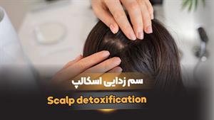 Scalp detoxification(سم زدایی اسکالپ)