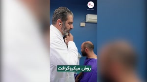 کاشت مو برای افراد طاس: راهکار تضمینی بدون نیاز به بانک مو