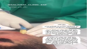 جوانسازی و حجم دهی پوست با Bio Filler Maker