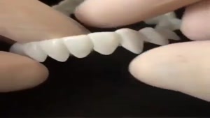  قابلیت‌ لمینت دندان بدون نیازبه چسب کاری و تراشیدن دندان