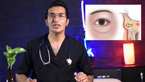 موثرترین راهکار برای درمان پف زیر چشم
