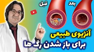 آنژیوی طبیعی برای باز کردن گرفتگی عروق قلب