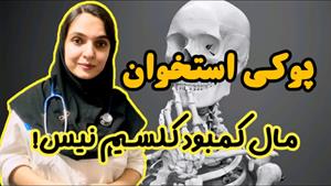 پوکی استخوان | پیشگیری و درمان 