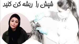 درمان قطعی شپش سر / روش از بین بردن شپش موی سر/ ریشه کن کردن