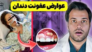 آبسه دندان باعث مرگ این بیمار شد| عوارض عفونت دندان چیه؟