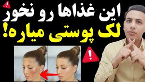 ترکیبات غذایی که باعث لک‌پوستی میشه| روش پیشگیری از لک‌پوستی