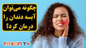 چگونه می‌توان آبسه دندان را درمان کرد؟