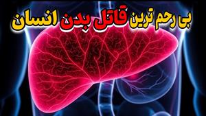 چگونه کبد خود را سالم نگه داریم؟