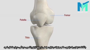 فیلم عمل جراحی تعویض مفصل زانو