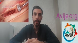 شرایط دریافت معافیت کم خونی و تالاسمی چه مواردی است؟