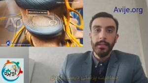 شرایط و ضوابط گرفتن معافیت پزشکی دیسک گردن