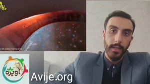 بیماری آسم و دریافت انواع معافیت پزشکی