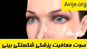 مراحل تایید بیماری جهت دریافت معافیت پزشکی شکستگی بینی چیست؟