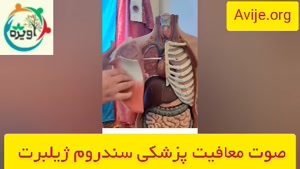 برای دریافت معافیت پزشکی ژیلبرت از کجا شروع کنم؟