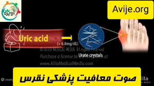 مدارک مورد نیاز معافیت پزشکی بیماری نقرس