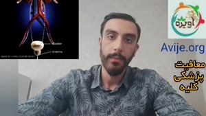 معافیت کلیه و شرایط کلی آن