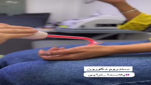 درمان التهابات بدن با دستگاه پزشکی Plasma Surgical