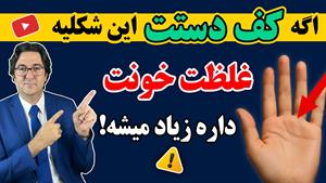 نشانه های غلظت خون در کف دست