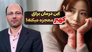 درمان سریع کهیر پوستی
