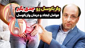 درمان واریکوسل و علت های آن