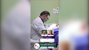 کاشت مو با مشاوره رایگان و شرایط پرداخت آسان