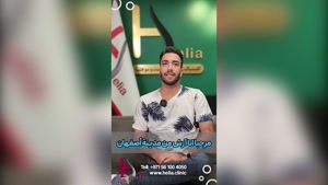 تجربه زیباجو کاشت مو بعد از 1 سال