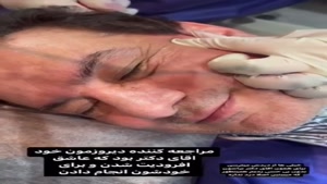 لیفتینگ و جوانسازی پوست با دستگاه پزشکی Aphrodite