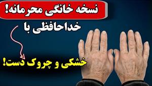 درمان خشکی و چروک دست