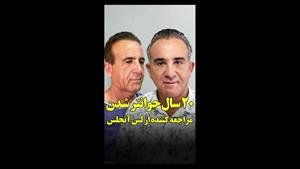 مراجعه کننده جراحی لیفت صورت و گردن از لس آنجلس