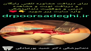 دندانپزشکی شبانه در تهران مطب دکتر حمید پورصادقی